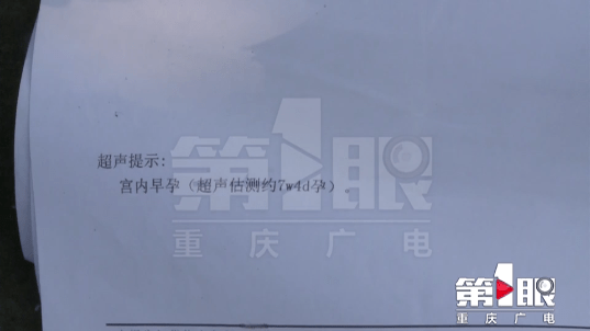 “ky开元·(中国)集团官网”
23岁女人全麻做整形 术后2天恶心反胃 一查呆住：有身了！(图7)