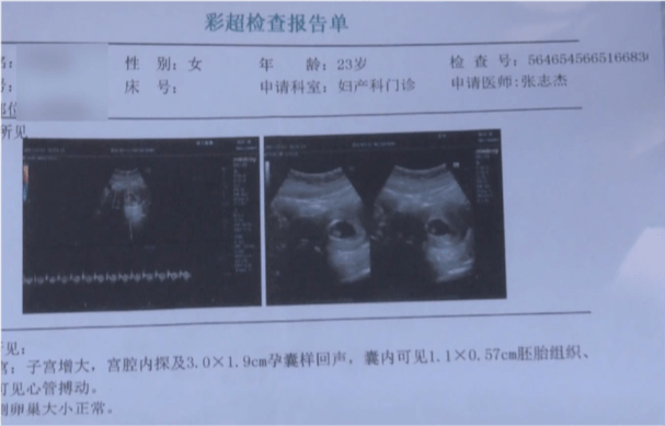 “ky开元·(中国)集团官网”
23岁女人全麻做整形 术后2天恶心反胃 一查呆住：有身了！(图6)